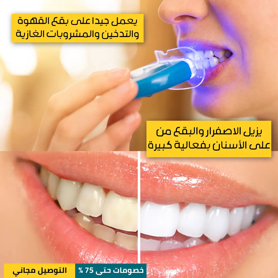 معجون تبييض الأسنان