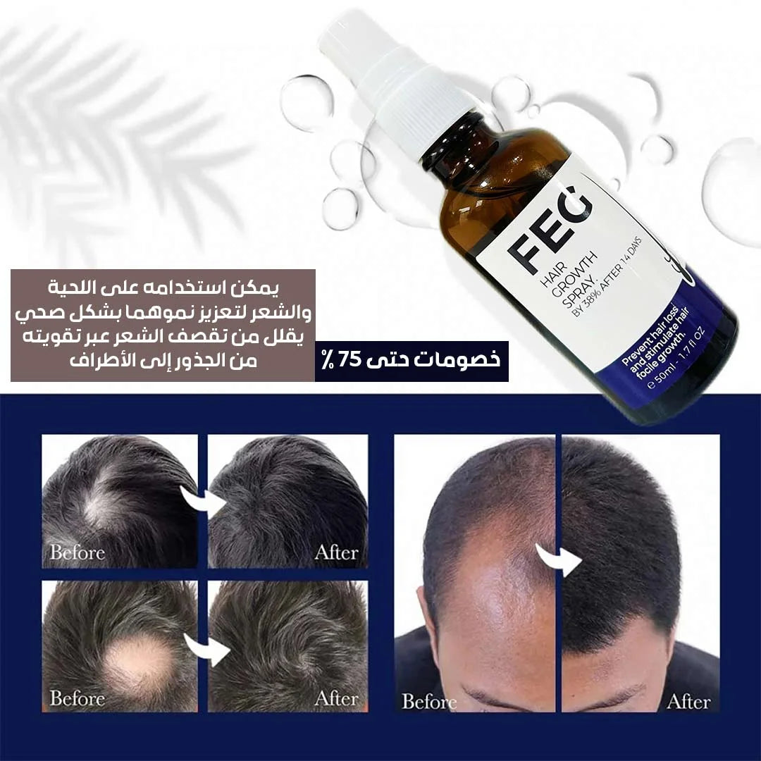 بخاخ نمو الشعر FEG