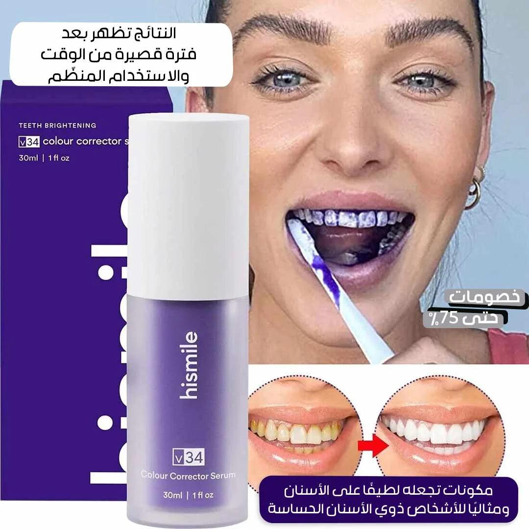 جل تبييض الأسنان