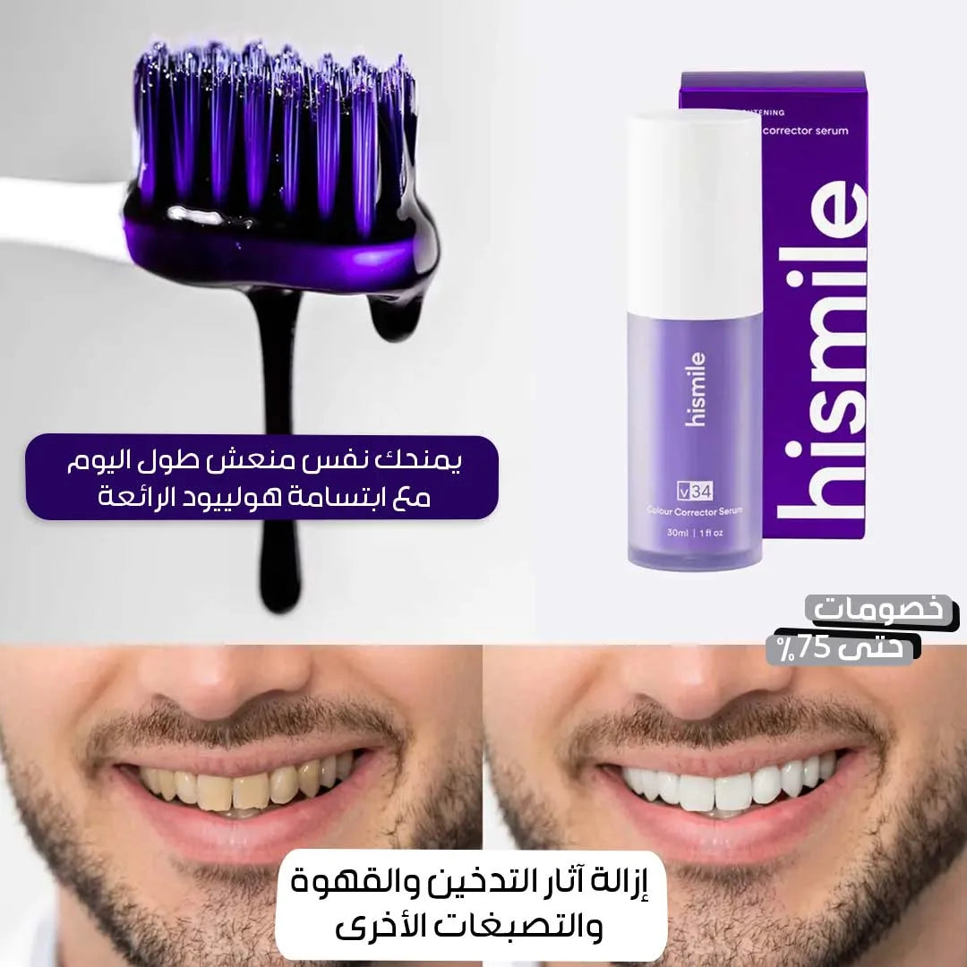 جل تبييض الأسنان