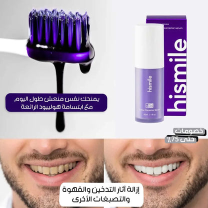 جل تبييض الأسنان